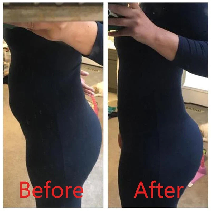 Shapewear Women Full Body Shaper Slimming Bodysuit Open Crotch Corset Waist Trainer Shaping Underwear Butt Lifter Lingerie Fajas