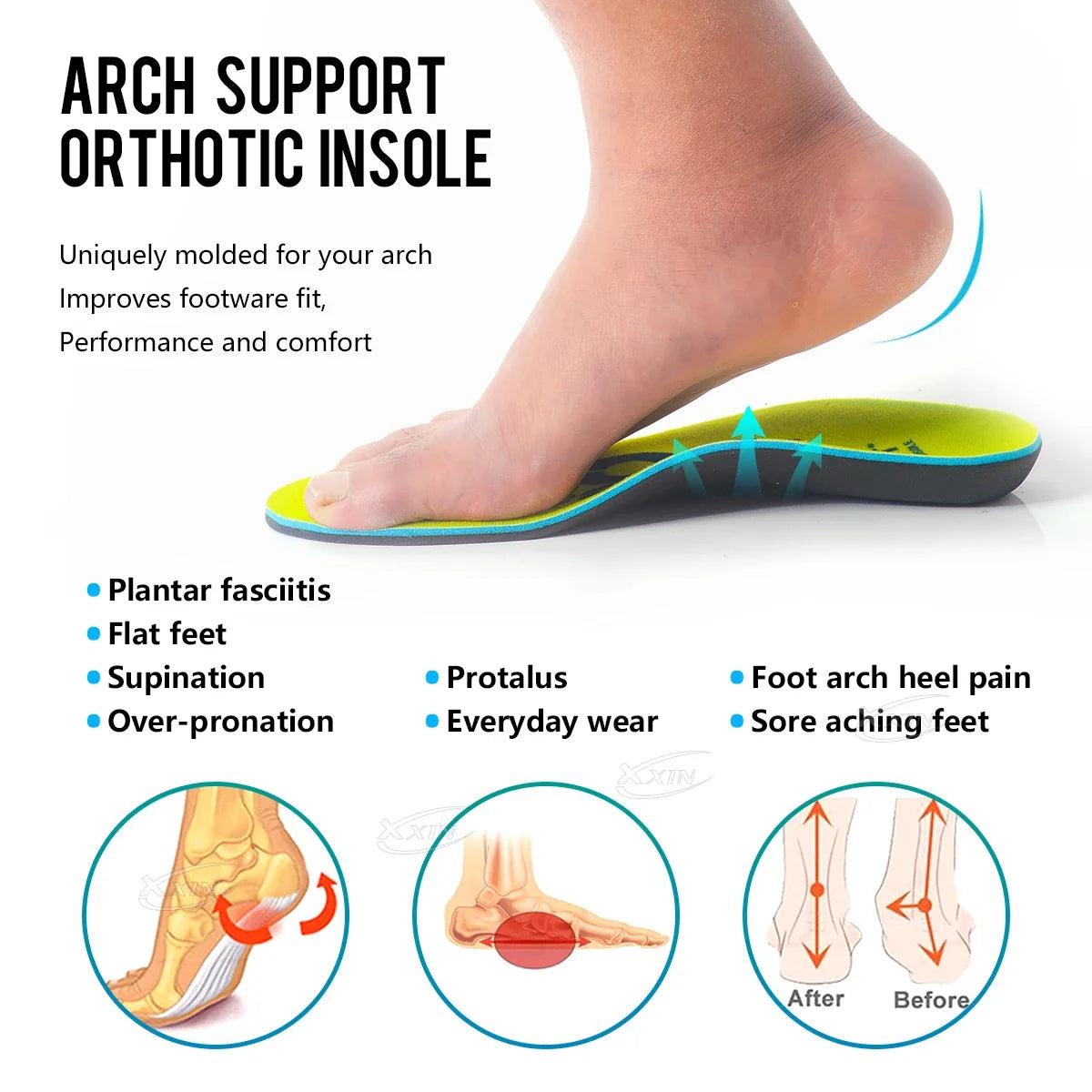 【Xxin】Arch Support Insole Orthopedic Insole Men Women Sport Shoe Insert Flat Foot Shoe Pad Size35-46